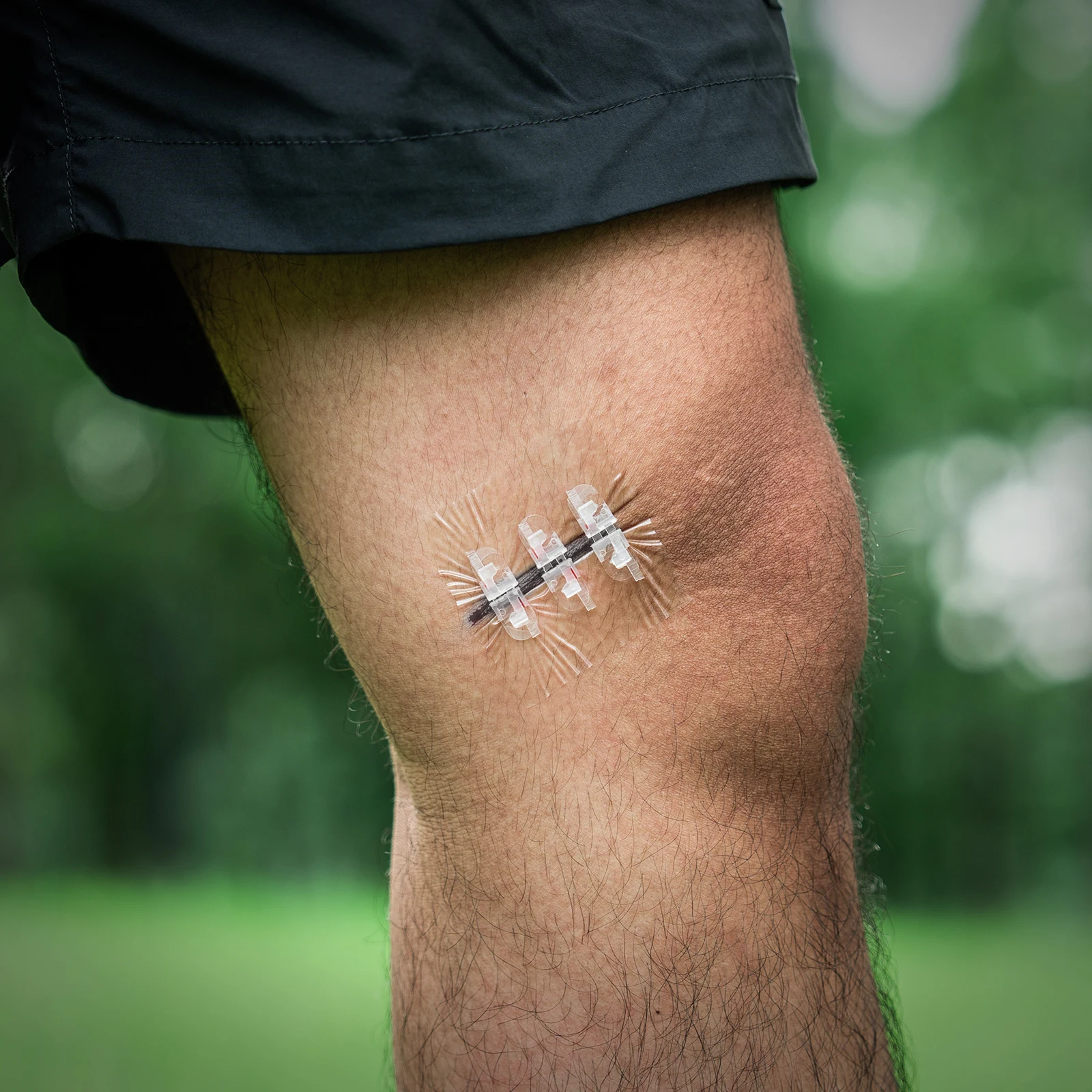 RHINO RESCUE Punto de cremallera con apósitos para heridas, tiras de cierre de heridas, kit de cierre de lacación con puntada de cremallera para el cuidado del corte Tirita - imagen 3