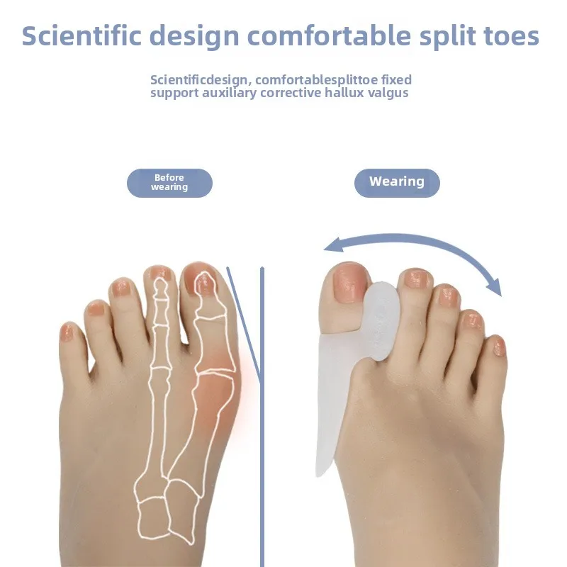 Corrector de pulgar de Gel de silicona, Protector de juanete, dedo del pie, Hallux Valgus, separador, alisador de dedo, ajustador, herramienta de cuidado de los pies, 2 uds. - imagen 3