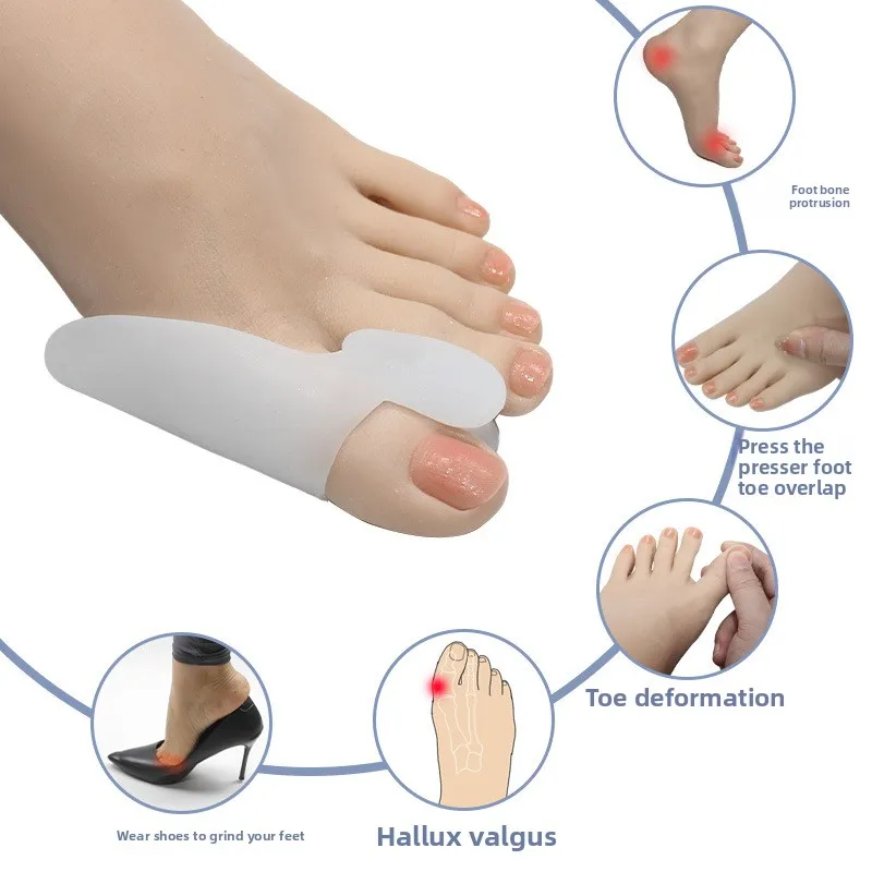 Corrector de pulgar de Gel de silicona, Protector de juanete, dedo del pie, Hallux Valgus, separador, alisador de dedo, ajustador, herramienta de cuidado de los pies, 2 uds. - imagen 4