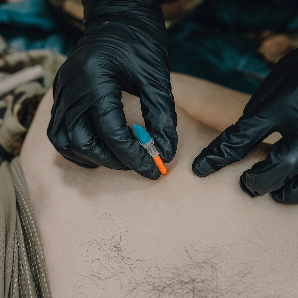 Aguja de neumotórax de rescate RHINO: Kit experto de ventilación y descompresión de pecho de emergencia, cuidado de heridas de pecho - imagen 4