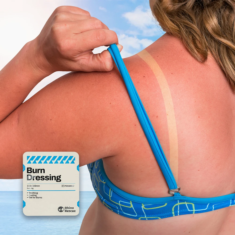 Gel para el cuidado de quemaduras de emergencia, crema calmante refrescante para aliviar las quemaduras solares, comodidad instantánea para quemaduras - imagen 3