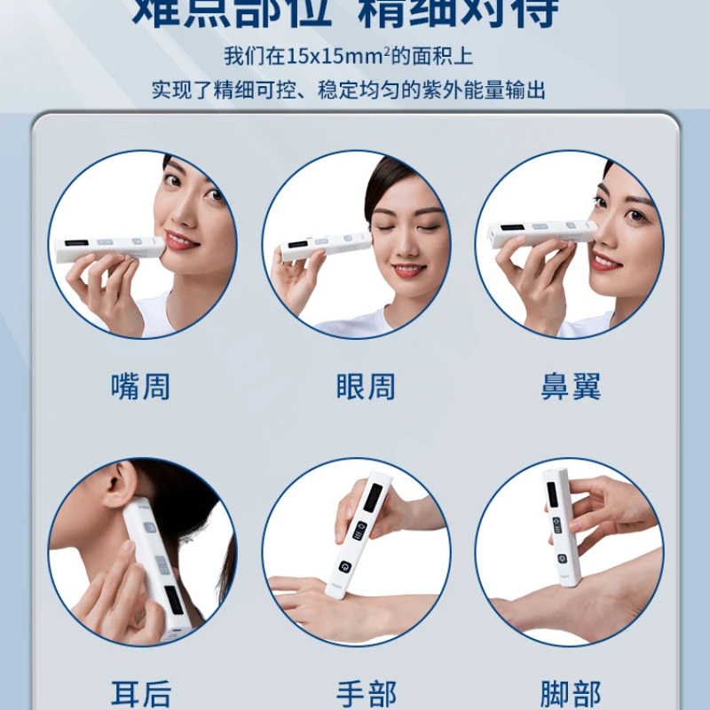 Palo de fototerapia NBUVB para Psoriasis Vitiligo, lámpara de terapia UV para el hogar, 308nm - imagen 2