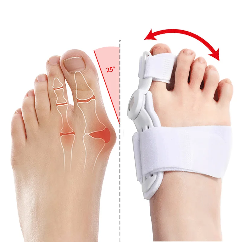 Corrector hallux valgus para juanetes – separador de dedos cómodo - imagen 2