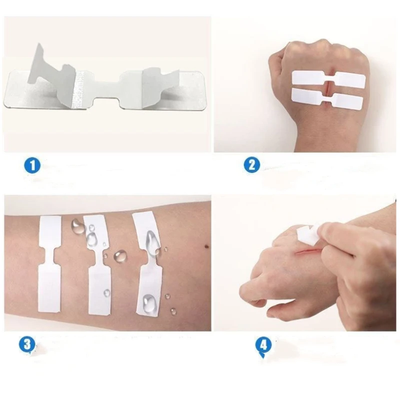Tiras adhesivas para cierre de heridas sin suturas impermeables - imagen 5
